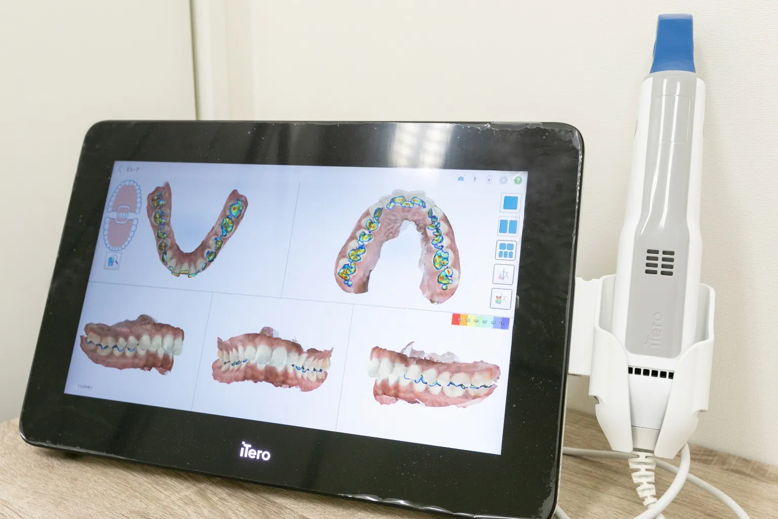 マウスピース型矯正歯科装置 「アイテロ」によるマウスピース型矯正歯科装置(インビザライン)